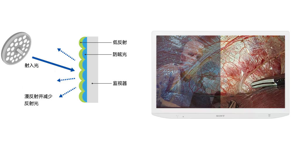 在明亮的手術室中盡量減少屏幕反射